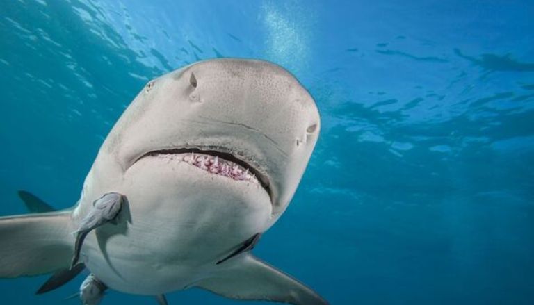 Victim of Shark aAttack in the Bahamas Set to Leave Florida Medical Center