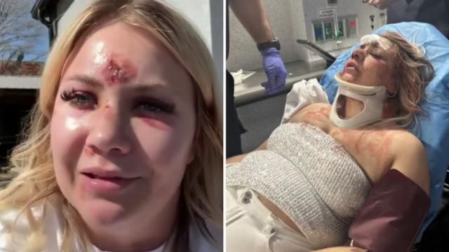 Bride-to-Be Assaulted and Hospitalized Just Weeks Before Wedding at Dallas Bachelorette Party