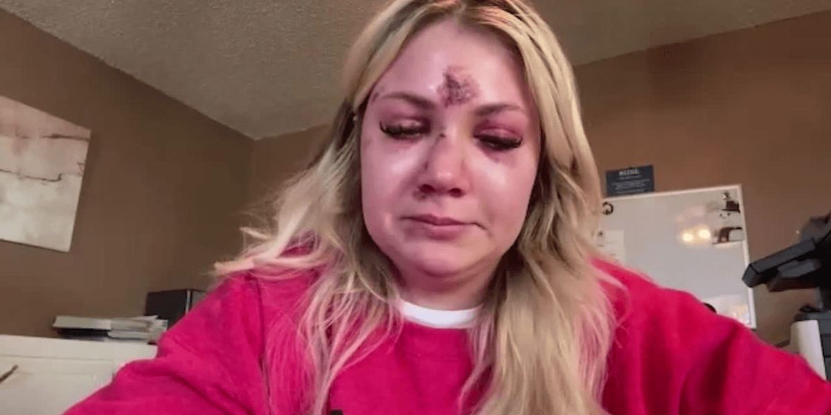 Bride-to-Be Assaulted and Hospitalized Just Weeks Before Wedding at Dallas Bachelorette Party