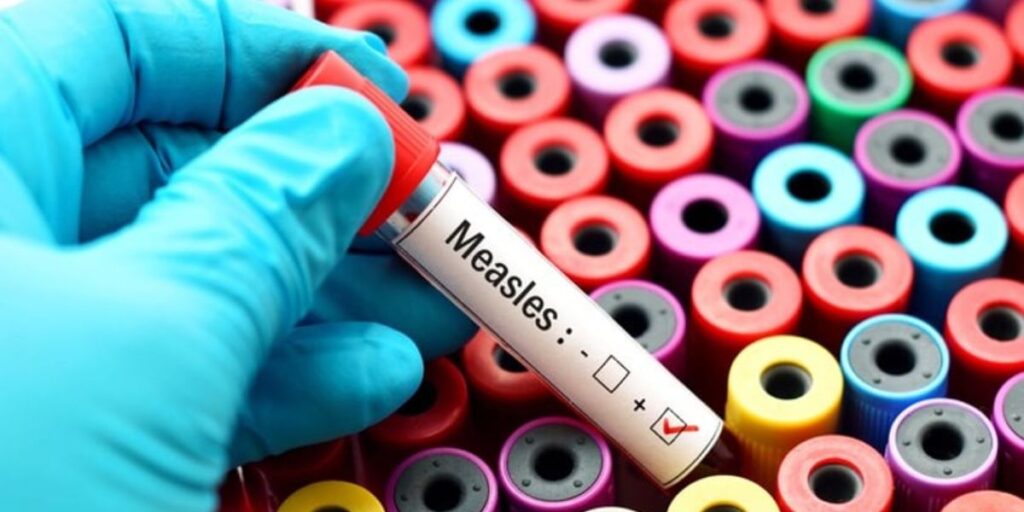 Kansas Sees Doubling of Measles Cases, New Outbreak in Ohio Sickens 10