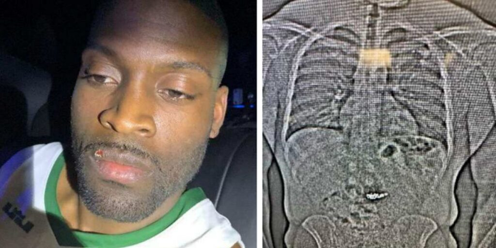 Man Who Posed as NBA Player Rep Swallows $769K in Stolen Tiffany Jewelry, Police Report