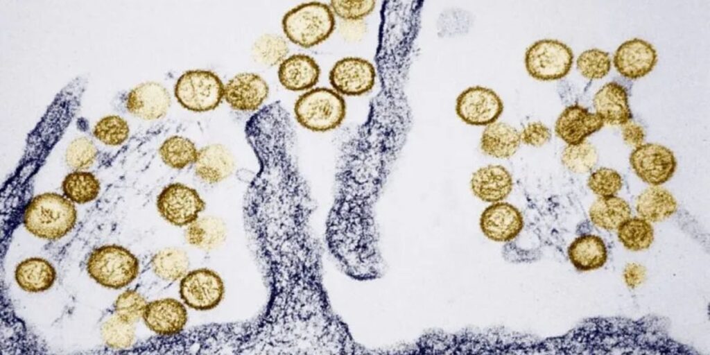 Rare Virus Claims Third Life in California, Linked to Gene Hackman’s Wife’s Death